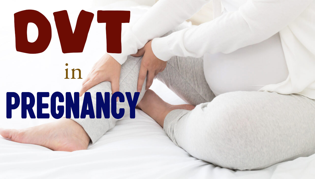 DVT in pregnancy